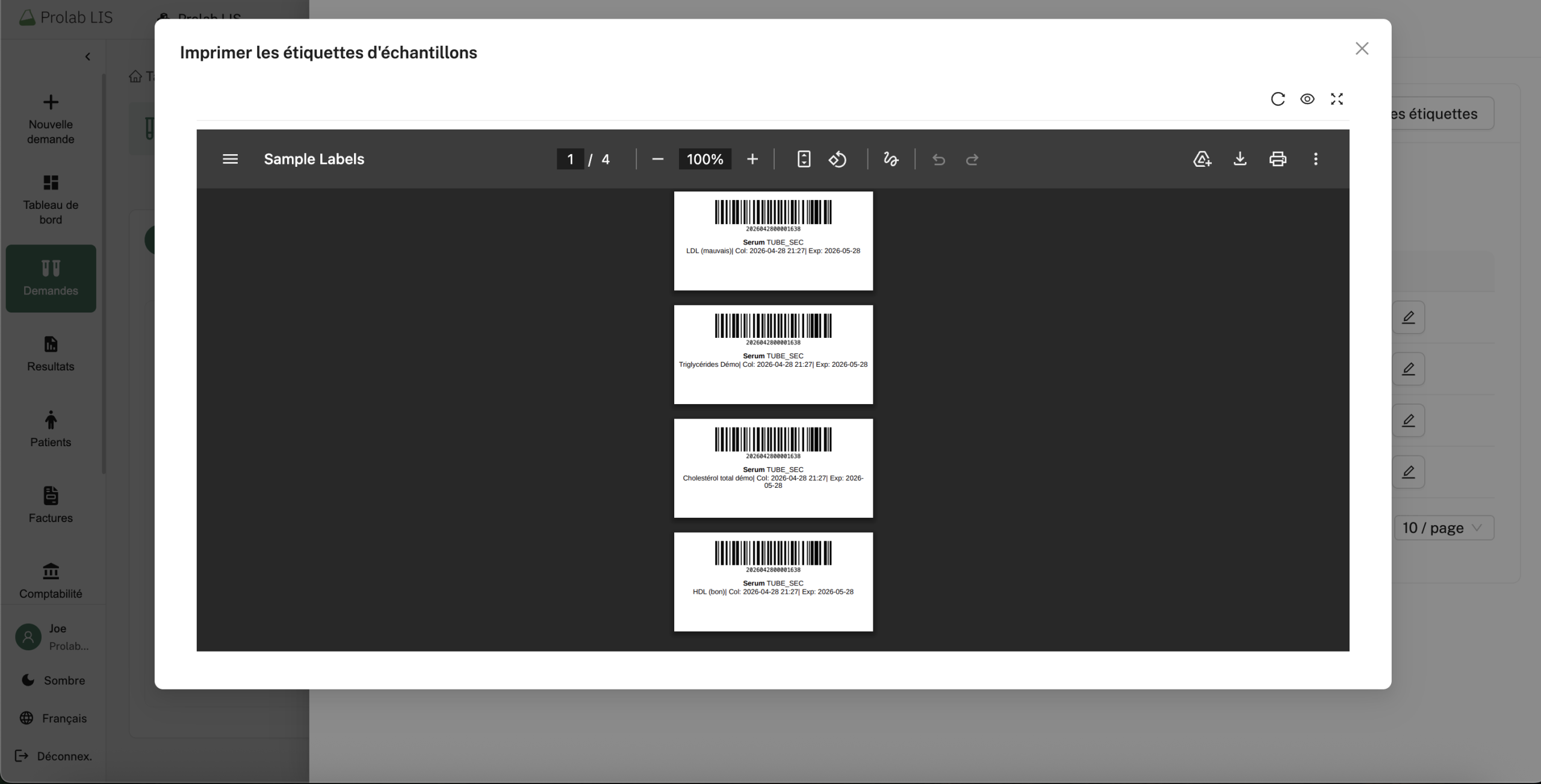 Impression des étiquettes codes-barres des tubes